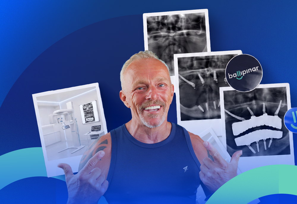 Zygomatic implant patient with panoramic X-rays of his treatment